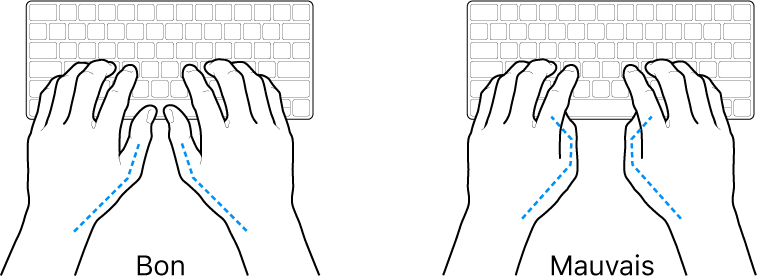 Mains placées sur un clavier, montrant la bonne et la mauvaise position des pouces.